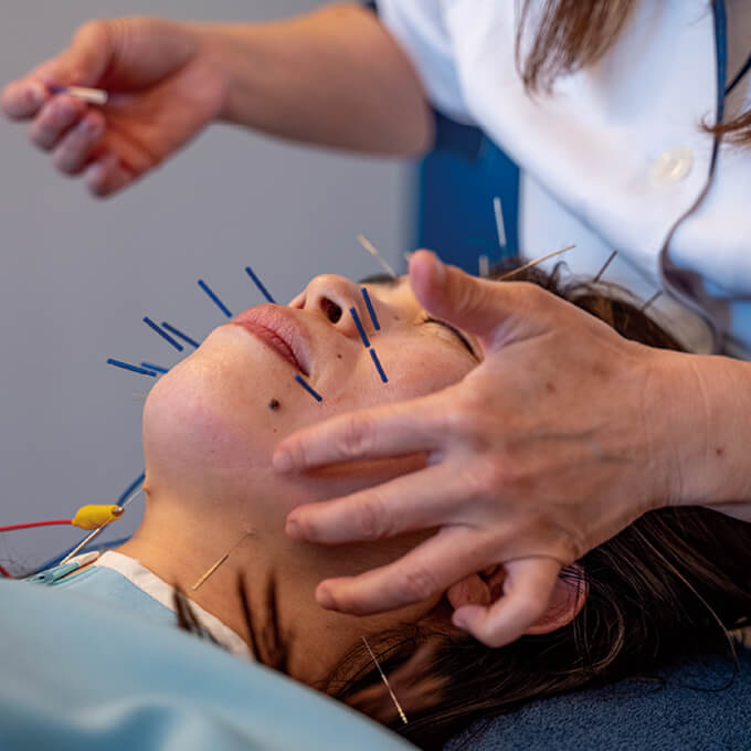 美容鍼灸